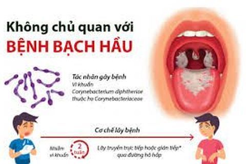 Bệnh bạch hầu: Nguy hiểm, không thể coi thường