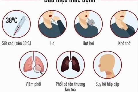 Một số triệu chứng lâm sàng khi nhiễm Covid-19