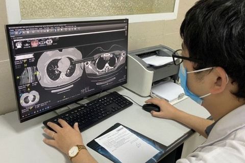 10 dấu hiệu cảnh báo cần đi khám hậu Covid-19