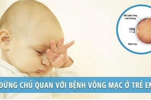 Không để trẻ mắc bệnh võng mạc trì hoãn khám vì dịch Covid-19