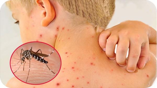 Tăng cường công tác phòng, chống dịch bệnh sốt xuất huyết trên địa bàn