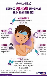 Dấu hiệu, nguyên nhân, chuẩn đoán và cách phòng bệnh sởi
