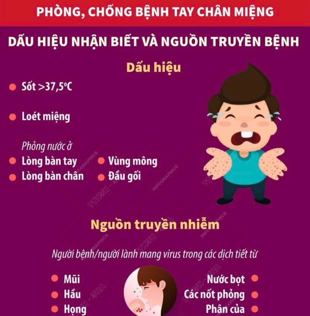 Phòng chống bệnh tay chân miệng ở trẻ nhỏ- Những điều cần biết