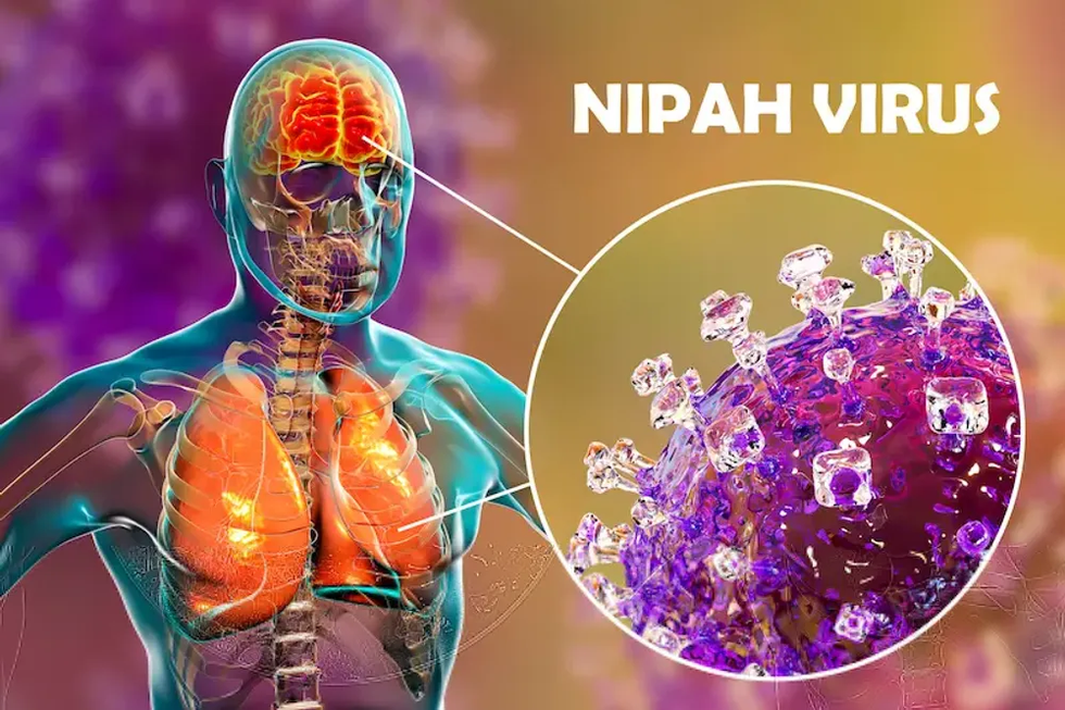 Những điều cần biết về loại virus Nipah nguy hiểm chết người - 2